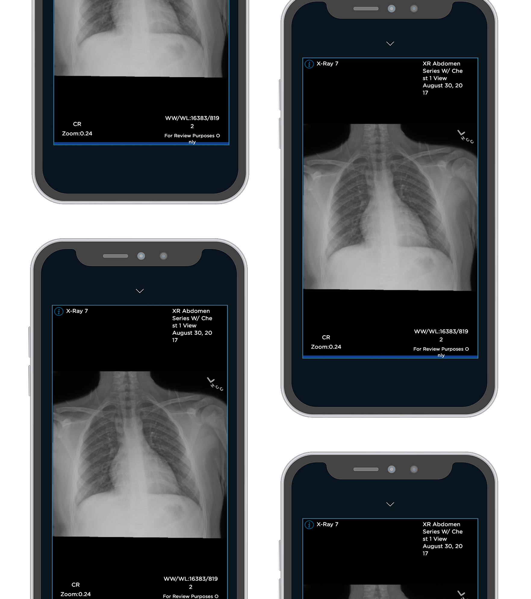 handxray2_lphone
